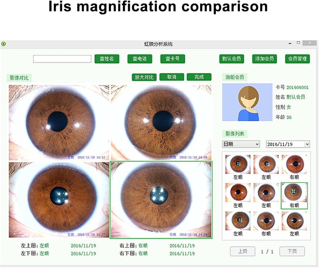 30X Portable Iris Scanner Analyzer, Professional Iris Camera for Health Analysis, Iris Check Device for Home Holistic Wellness 30X Portable Iris Scanner Analyzer, Professional Iris Camera for Health Analysis, Iris Check Device for Home Holistic Wellness