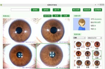 30X Portable Iris Scanner & Analyzer review 30X Portable Iris Scanner & Analyzer review